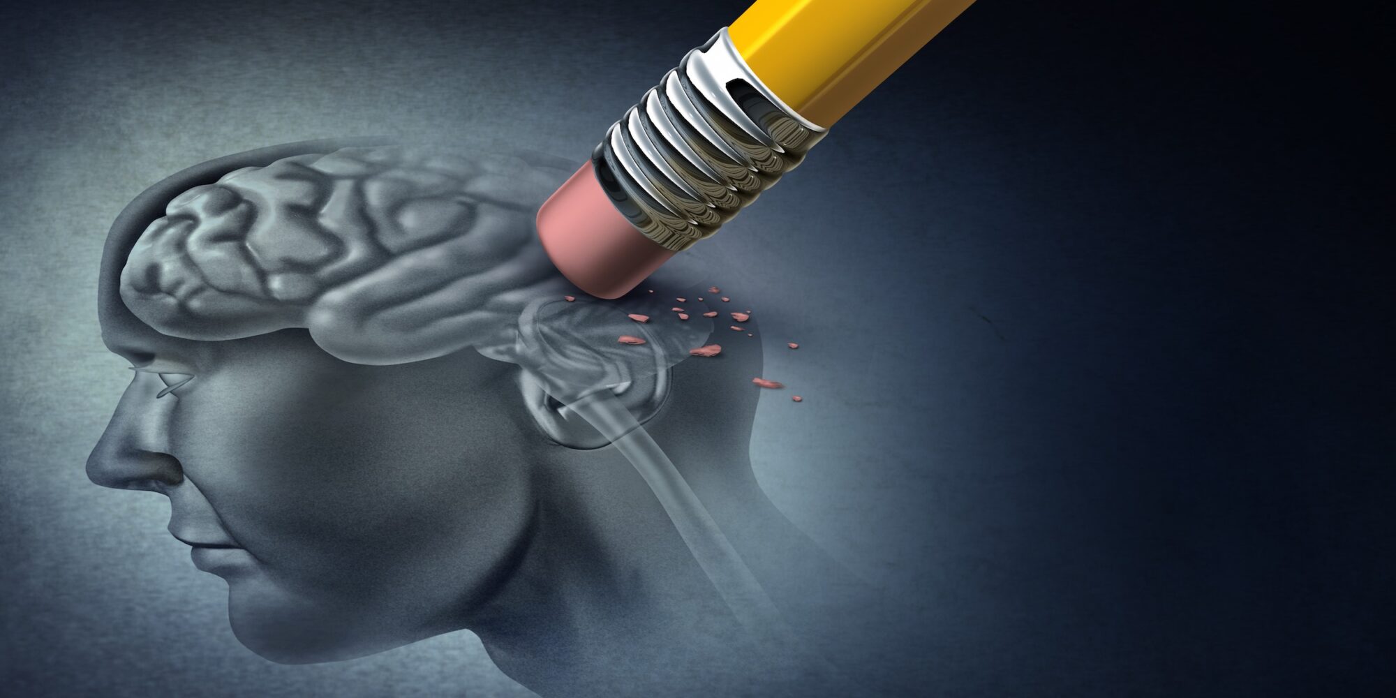 Concept of memory loss and dementia disease and losing brain function memories as an alzheimers health symbol of neurology and mental problems with 3D illustration elements.